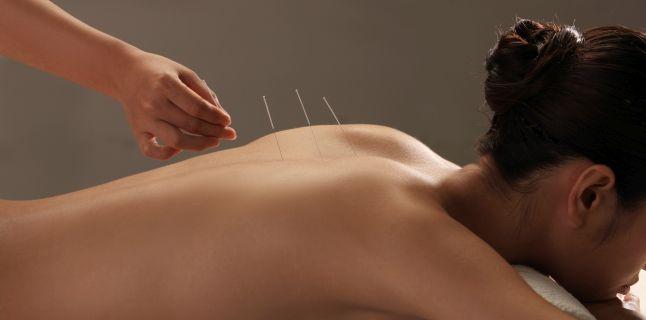 Ce este acupunctura si cum te ajuta ea?