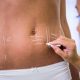 Cum functioneaza lipoaspiratia