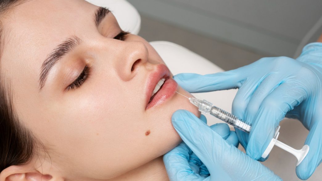 injectare acid hialuronic