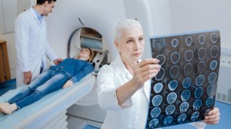 Ce înseamnă Tesla în contextul rezonanței magnetice?